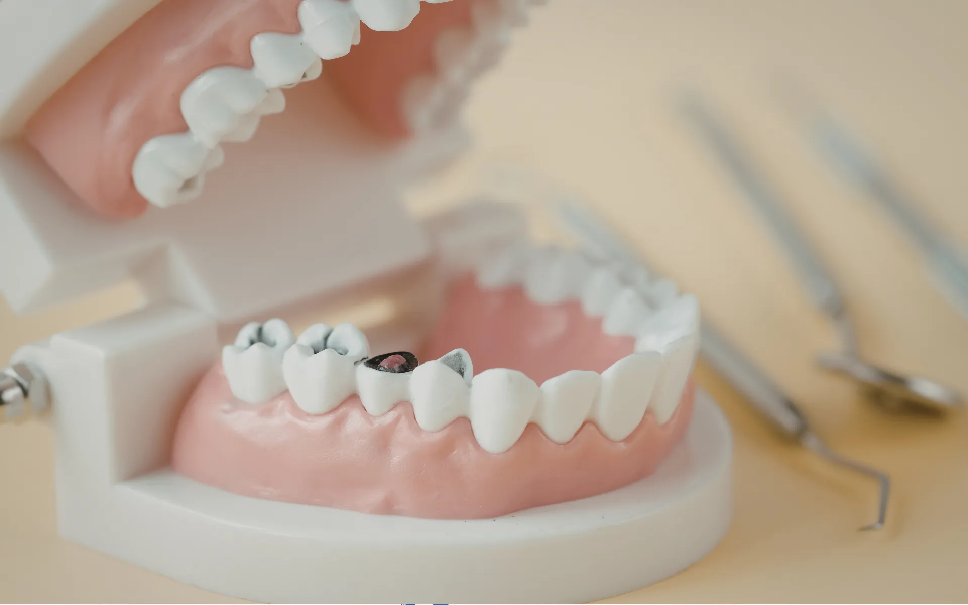 Dental implant procedure in UK clinic 2026