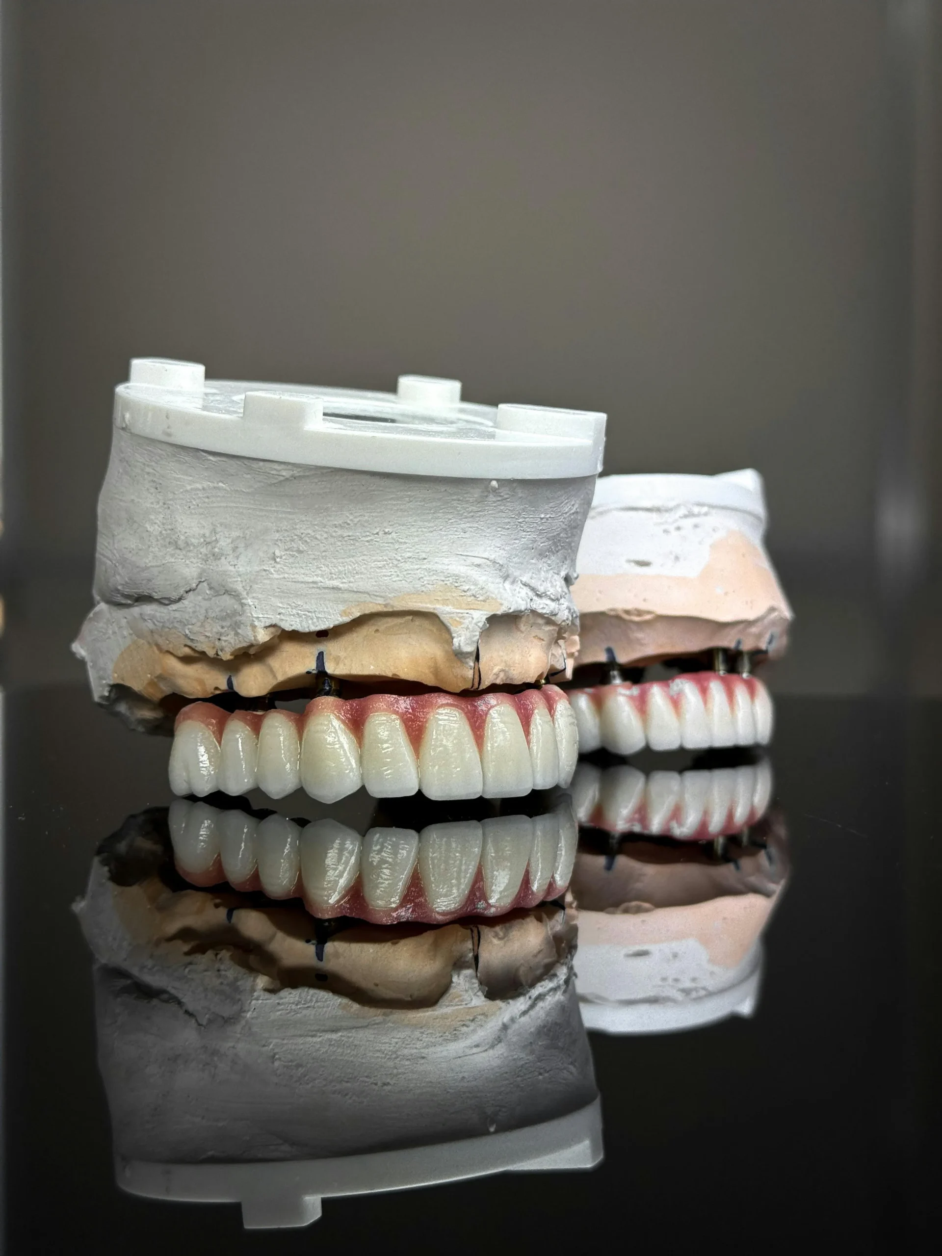 Dental implant cost consultation between dentist and patient in a modern UK clinic