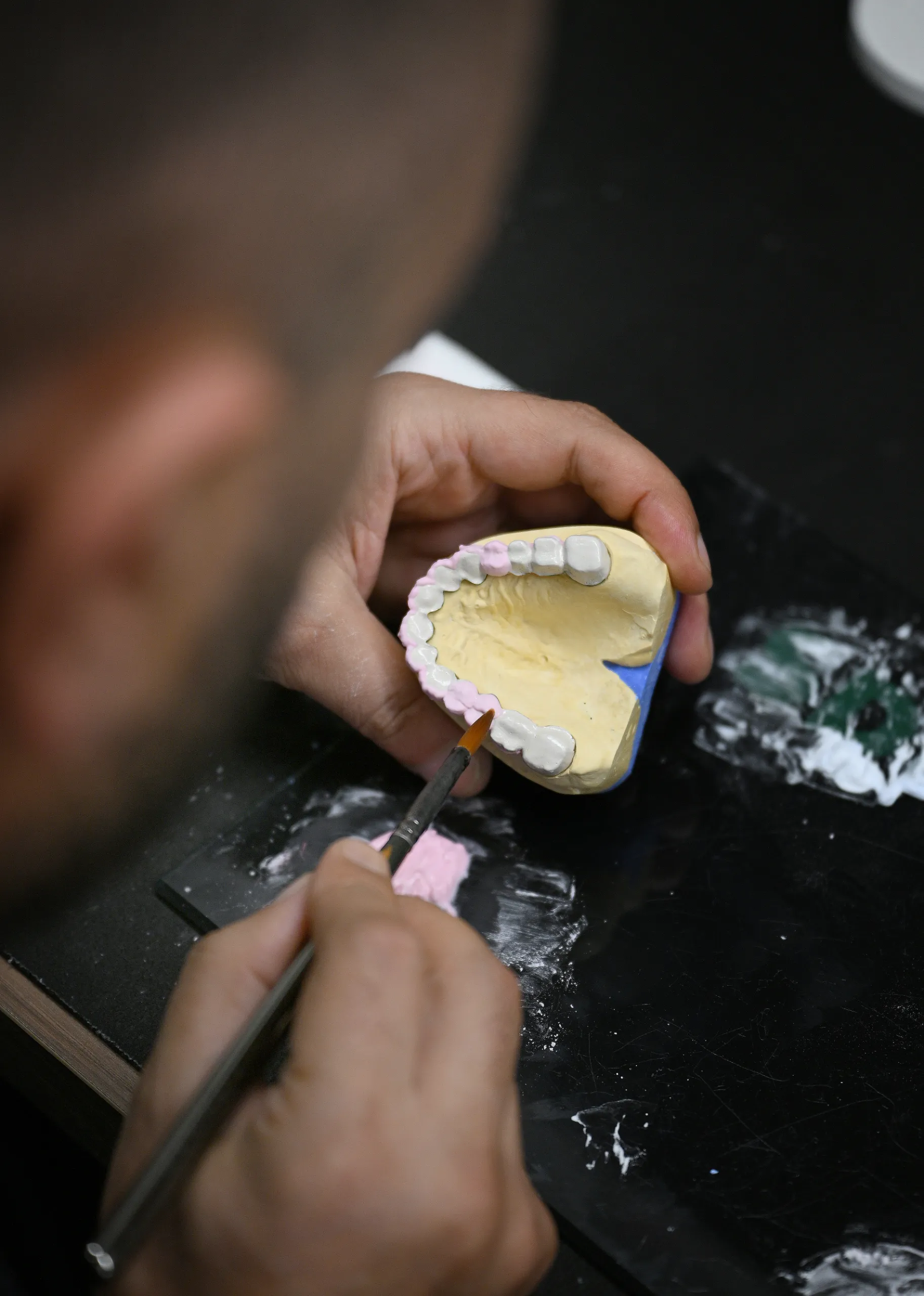 Custom dental restoration produced in the in-house lab