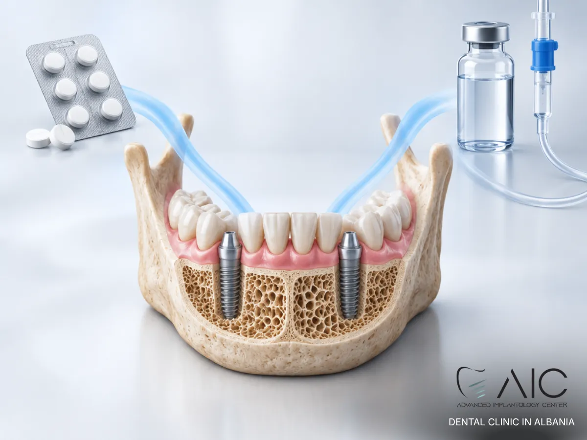 Oral and intravenous bisphosphonate therapy illustrated alongside dental implants in the jawbone